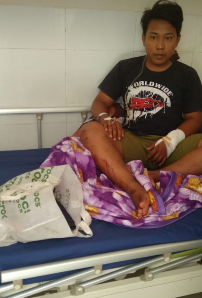 
 Foto : CW7  Caption : Rusli(23) korban begal saat menjalani perawatan di Rumah Sakit Handayani Kotabumi atas luka bacok yang dideritanya, Sabtu(2/6).
