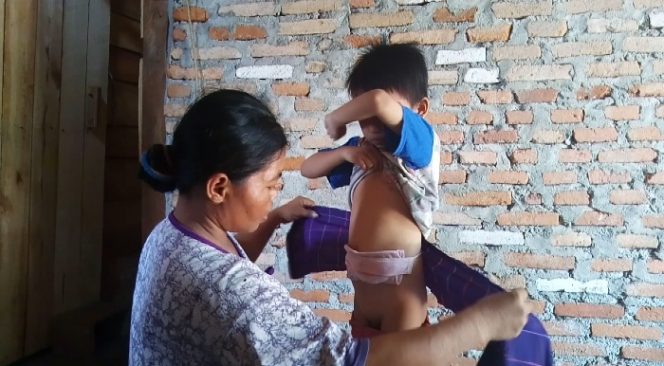 
 Tidak Miliki Anus, Temi Butuh Uluran Tangan Dermawan