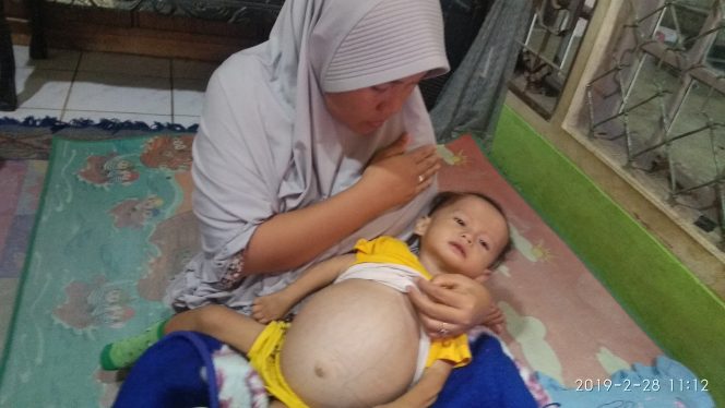 
 Mengidap Tumor Intraabdomen, Muttaqi Butuh Uluran Tangan
