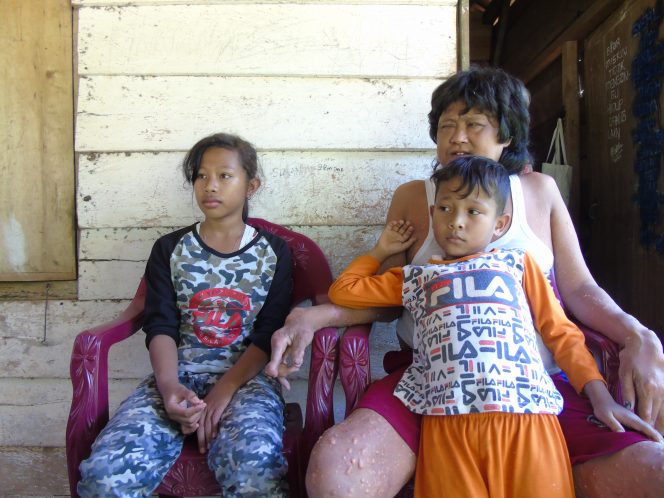 
 Janji Bantu Serli, Dinkes Lampura Ingkar Janji