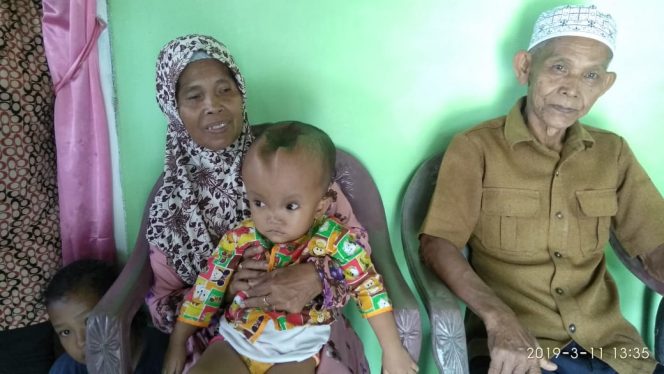 
 Foto Ferdani
Caption : Bocah Hyidrochepalus Batrisia Sabrina, warga Desa Bumijaya, RT I / RW II Kecamatan Abung Timur, Lampung Utara, saat berada dipangkuan neneknya. Foto dibidik Senin(11/3). 