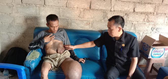 
 Caption foto : Dihari pertamanya sejak di lantik sebagai ketua DPRD Lampura, Romli berkenan mengunjungi kediaman Irwanto penderita kaki gajah, Selasa (15/10).