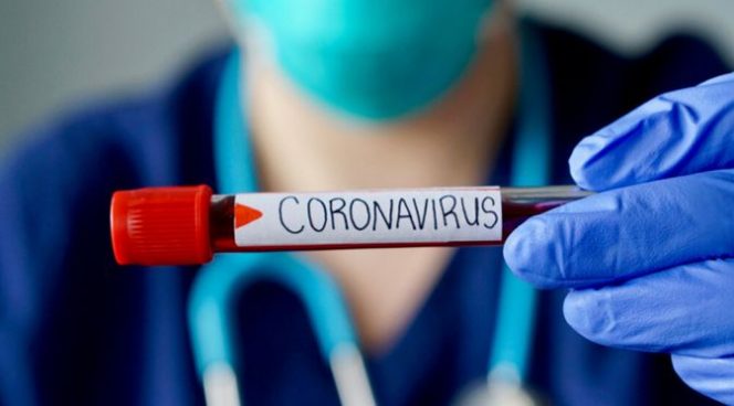 
 Sejumlah Wilayah Dilampura Ditetapkan Zona Merah Covid-19